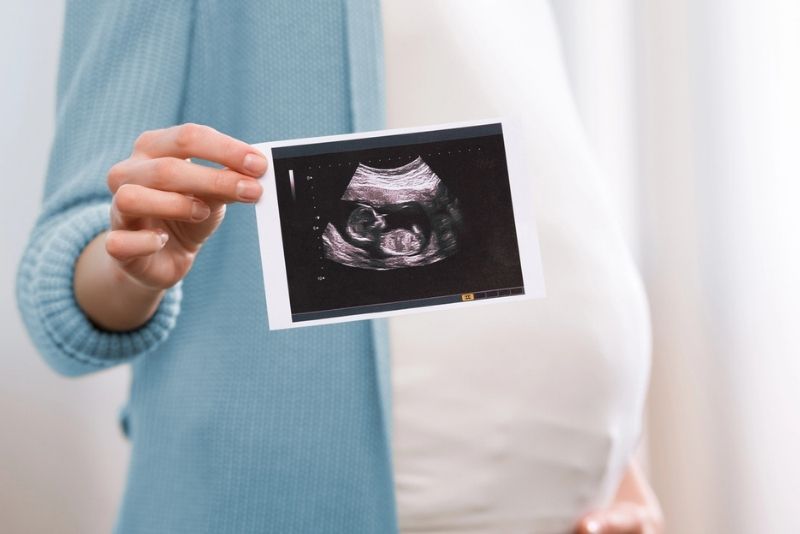 Foto da Postagem Destaque